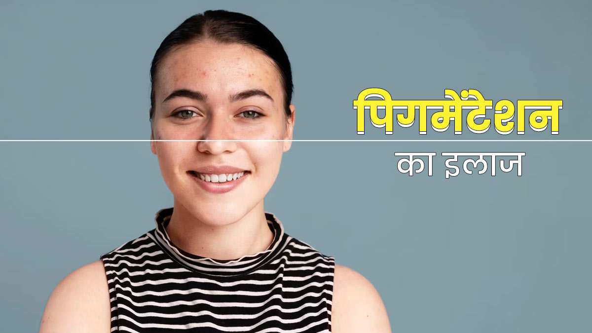 पिगमेंटेशन से चेहरा हो गया है काला? ऑलिव ऑयल से दूर करें झाइयां, जानें प्रयोग का तरीका