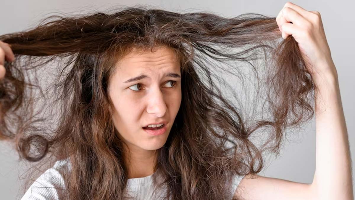 Troubled With Hair Fall & Itchy Scalp? Here Are 5 Home Remedies To Detoxify Your Scalp