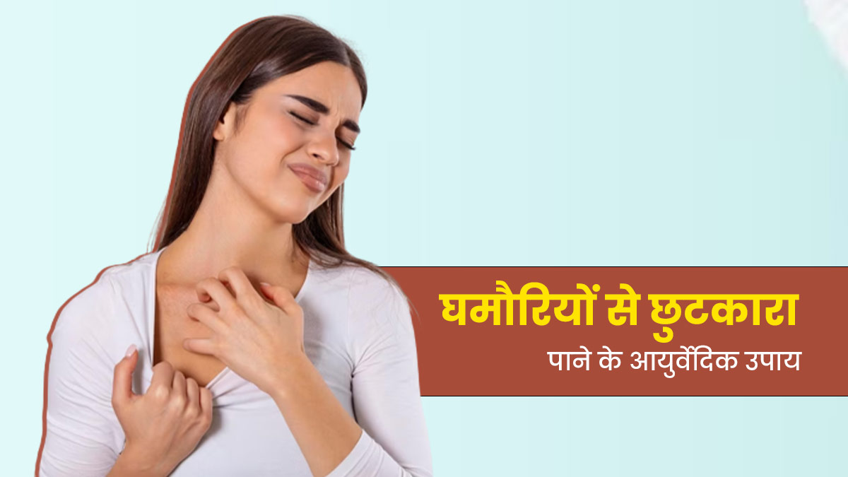 तेज धूप और गर्मी से हो गई हैं घमौरियां? इन 5 आयुर्वेदिक उपायों से मिलेगी जल्द राहत