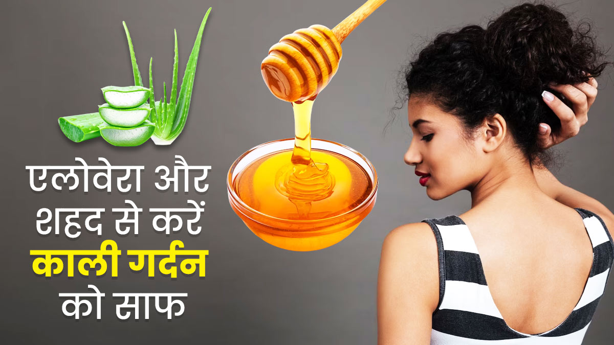 गर्मियों में काली पड़ी गर्दन को साफ करने के लिए लगाएं एलोवेरा और शहद, जानें इस्तेमाल का तरीका