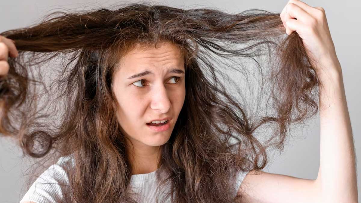 Troubled With Dry And Brittle Hair: Try These 4 DIY Shampoo Recipes To Reap The Benefits