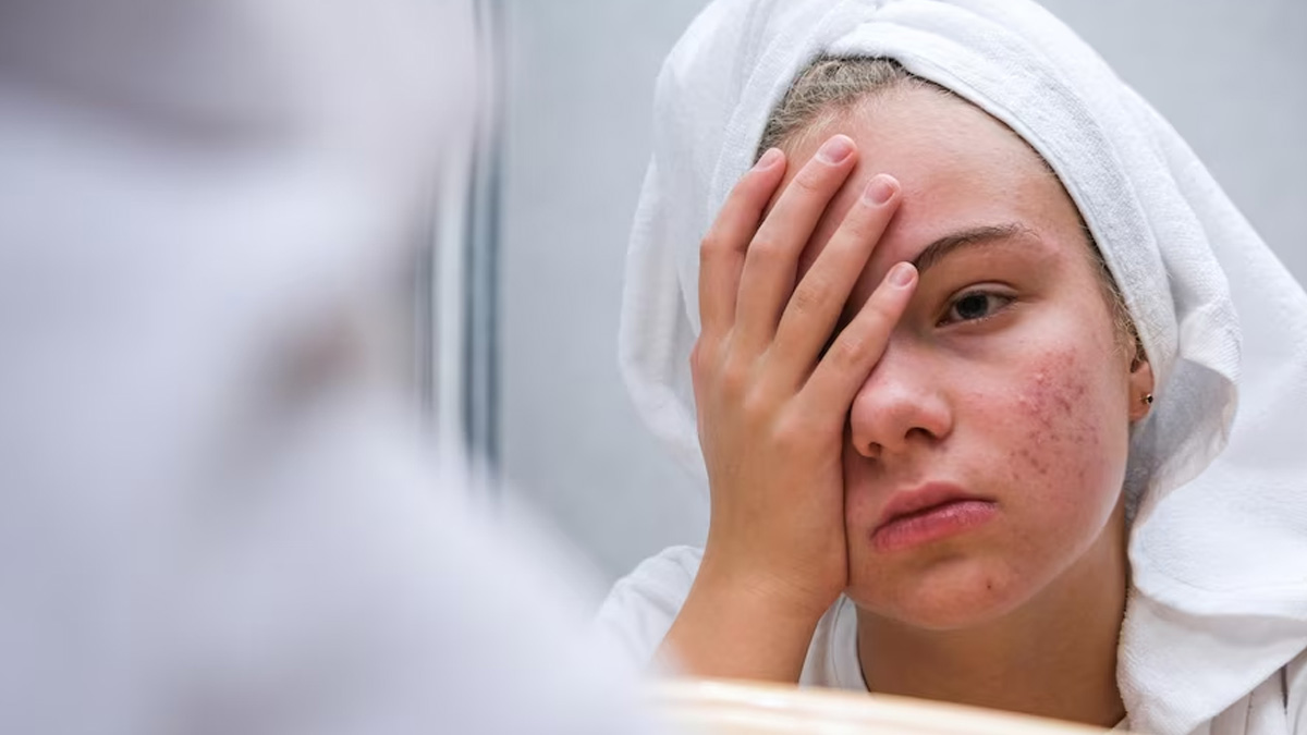 Side Effects Of Aloe Vera and Lemon