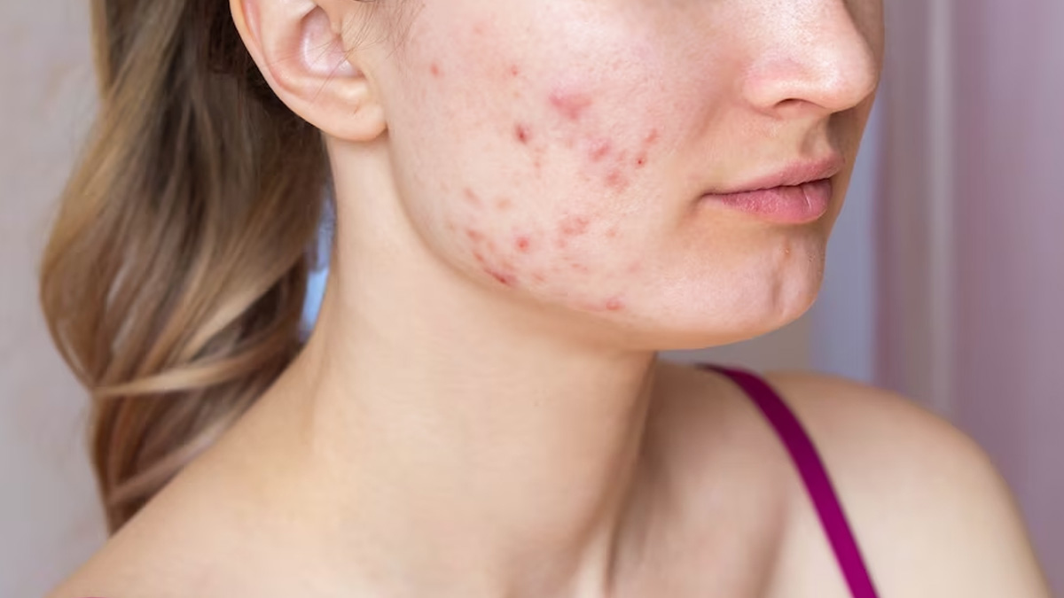 Face Shaving for Women