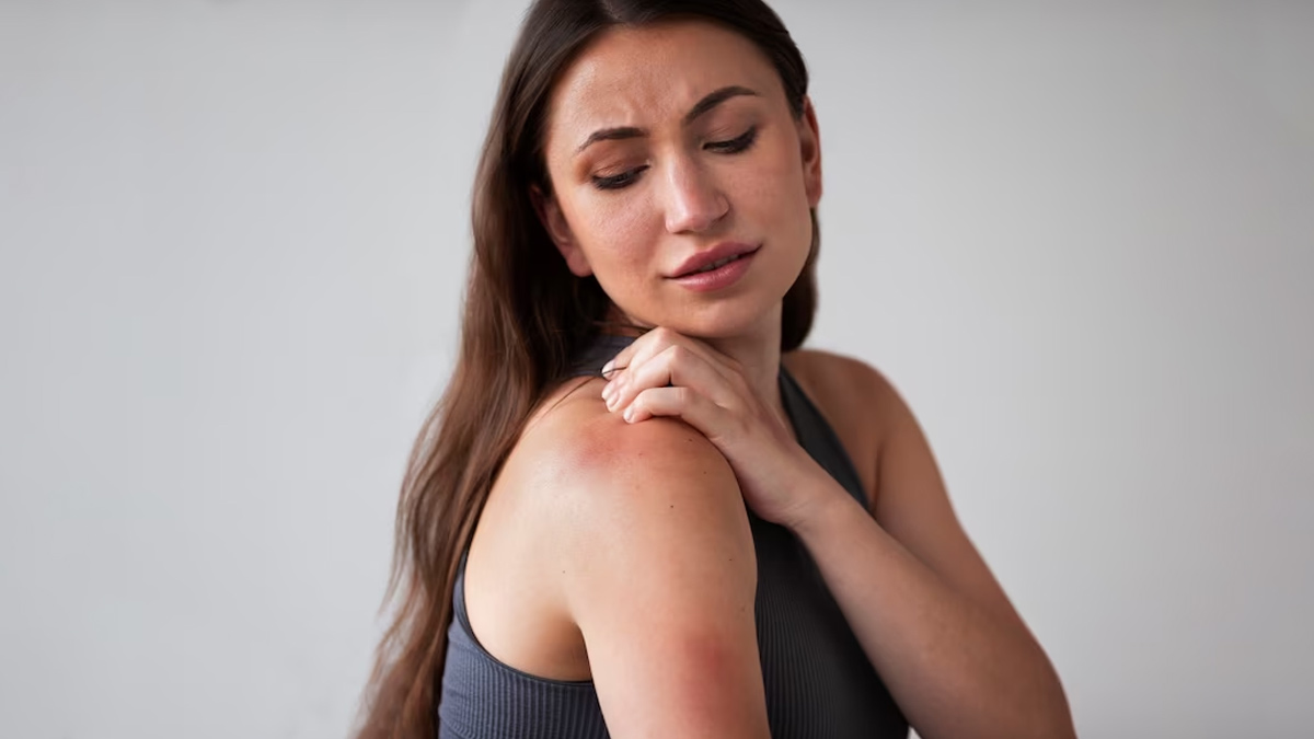 causes of mosquito bite