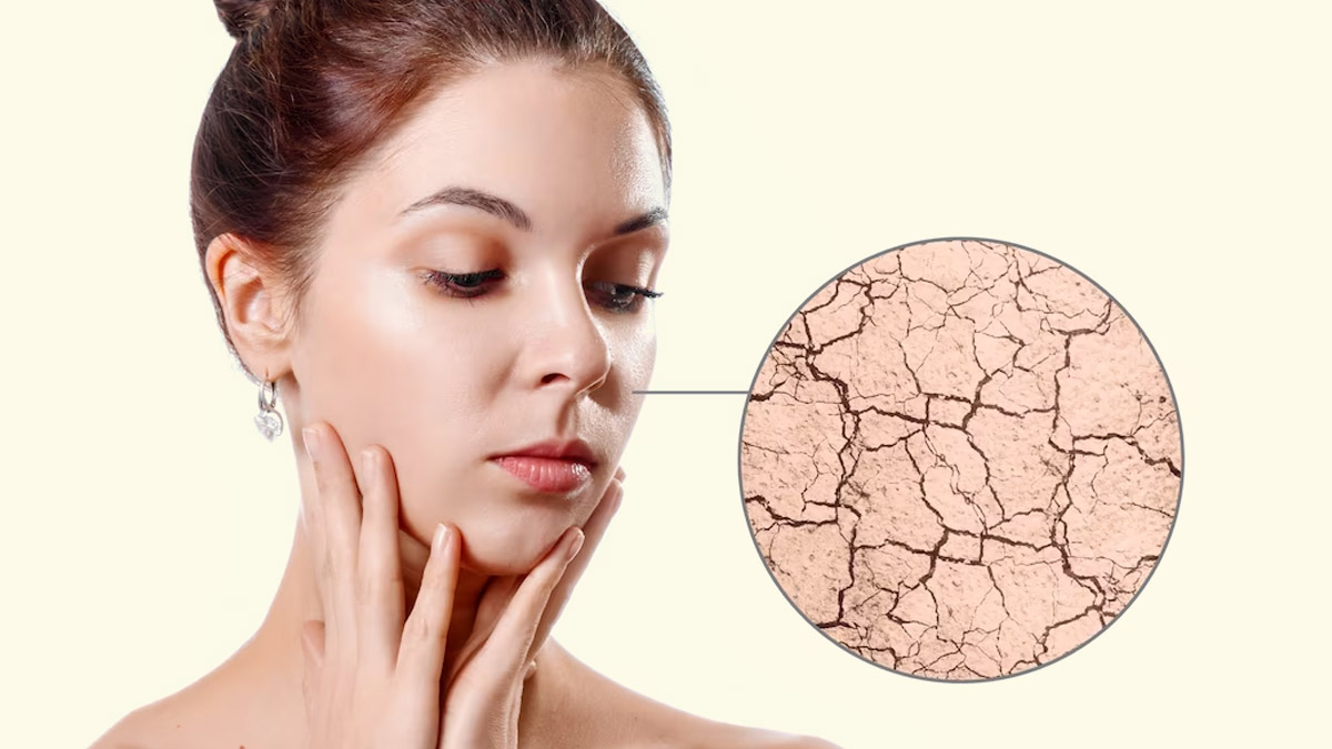 Thyroid-impact-on-skin