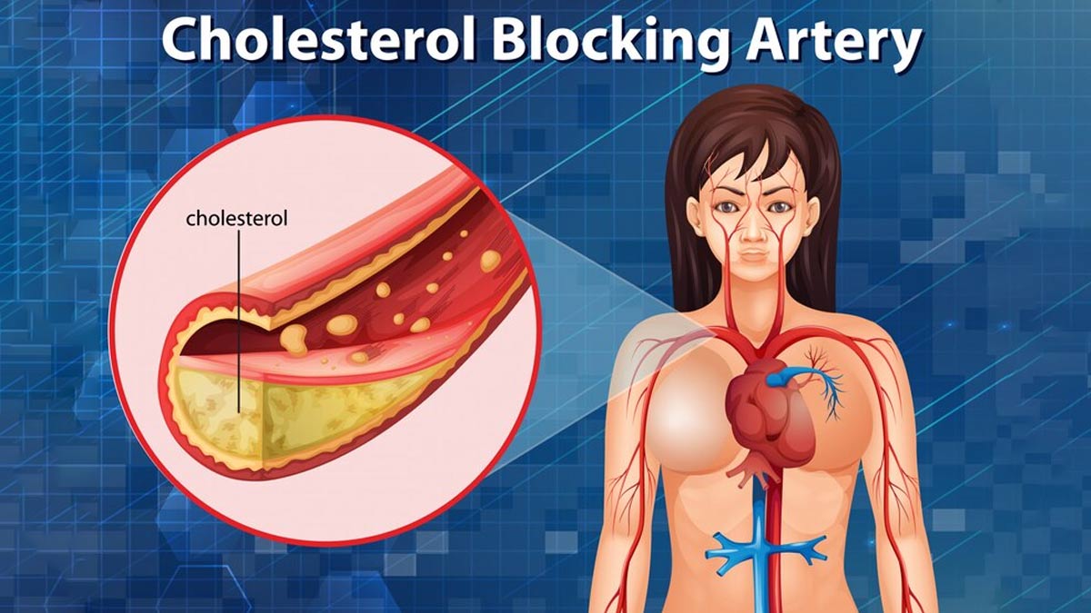 What Is Triglycerides In Hindi