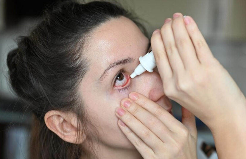 eye flu treatment in hindi