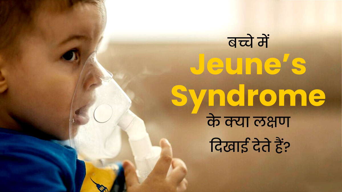 बच्चे को सांस लेने में परेशानी को न करें नजरअंदाज, Jeune syndrome का हो सकता है संकेत, जानें इलाज
