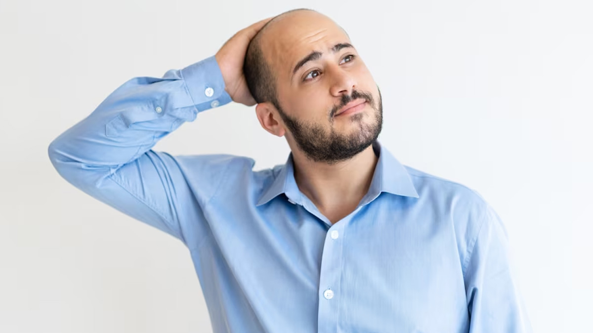 No Cure For Hereditary Hair Loss, But Here's How You Can Slow The Process 