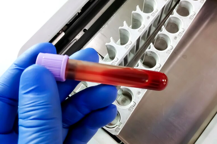 normal hemoglobin range in child