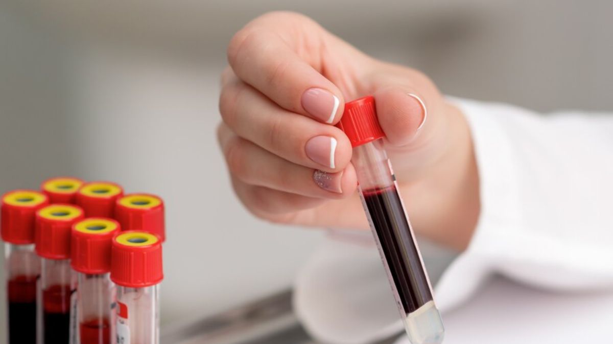 Why Blood is Red in Colour