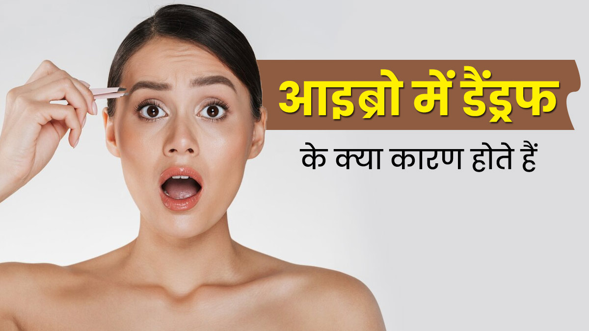 Eyebrow Dandruff: आइब्रो में डैंड्रफ की समस्या क्यों होती है? जानें बचाव के तरीका  