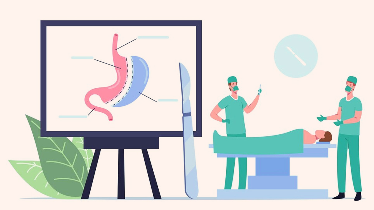 How To Avoid Nutritional Deficiency After Bariatric Surgery