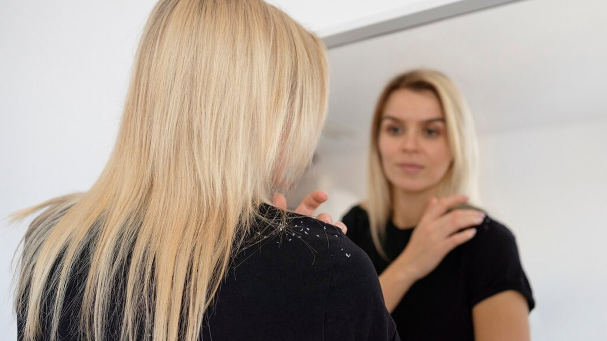 Clove Water Benefits To Reduce Dandruff