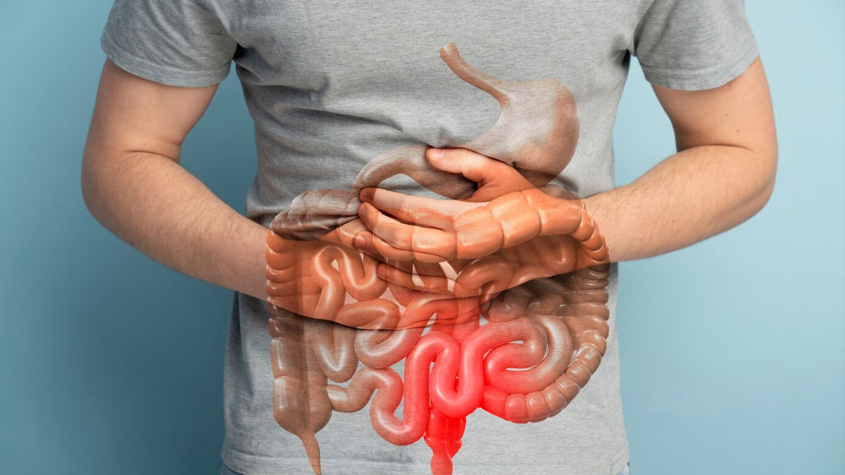 intestinal obstruction inside