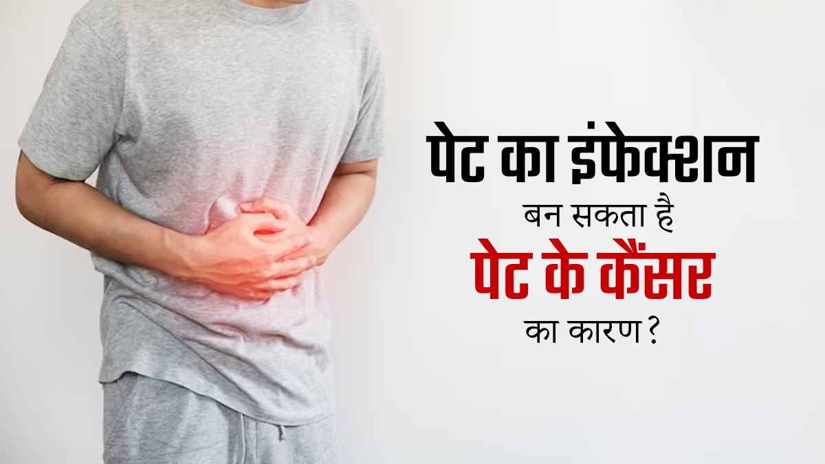 क्या पेट का इंफेक्शन बन सकता है Stomach Cancer का कारण? जानें डॉक्टर की राय 