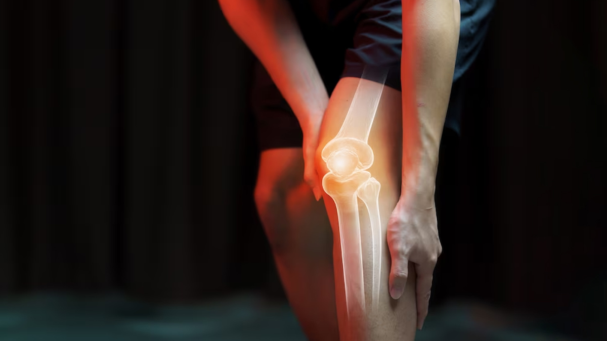 Expert Shares How Dense Fog May Worsen Rheumatic Disorders