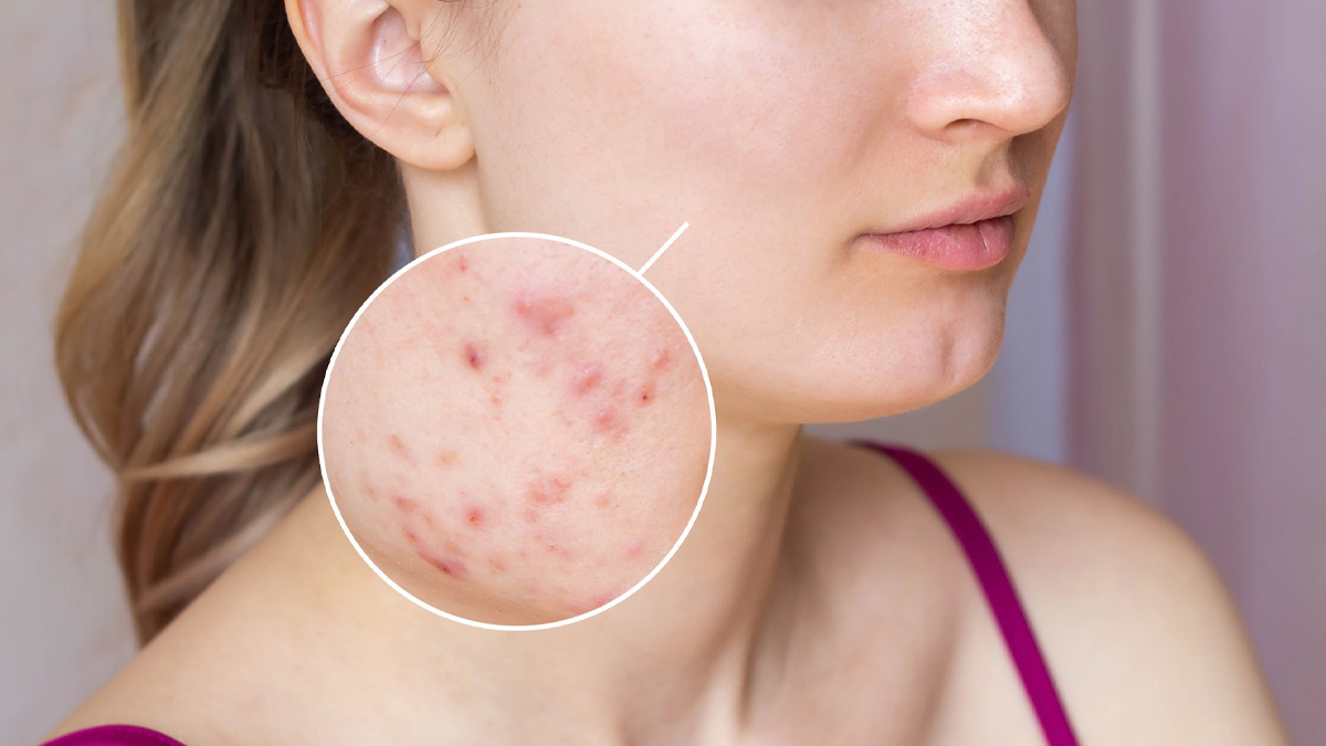 signs of low vitamin c