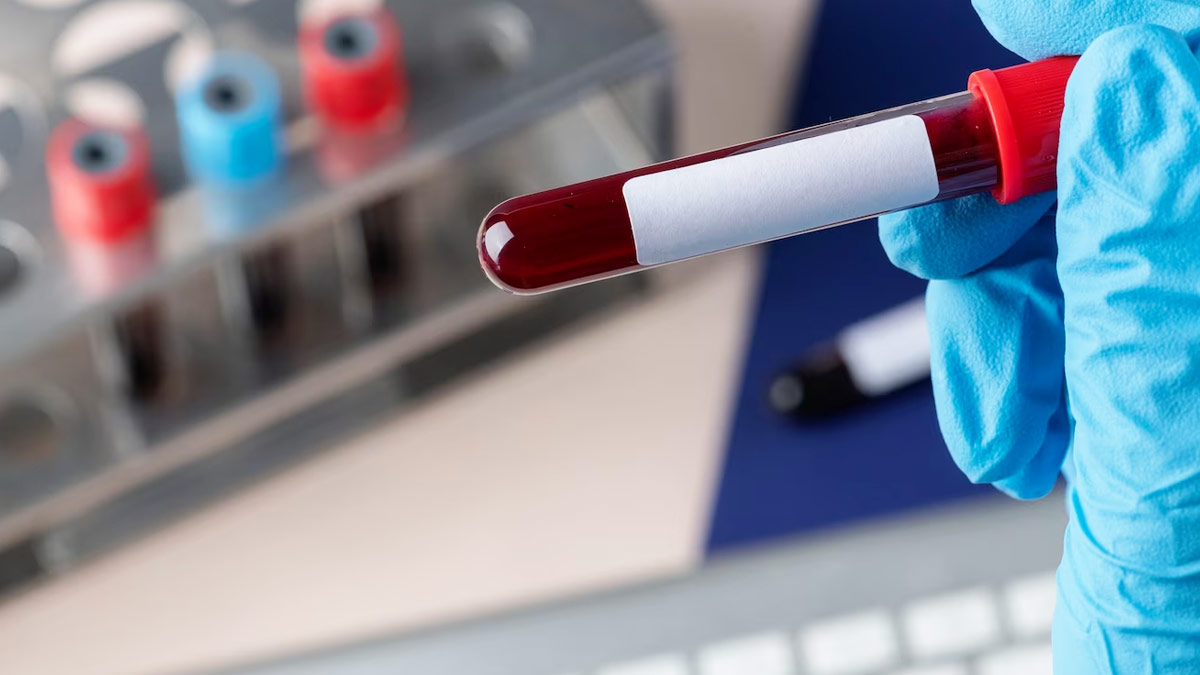 sickle cell anemia elimination mission