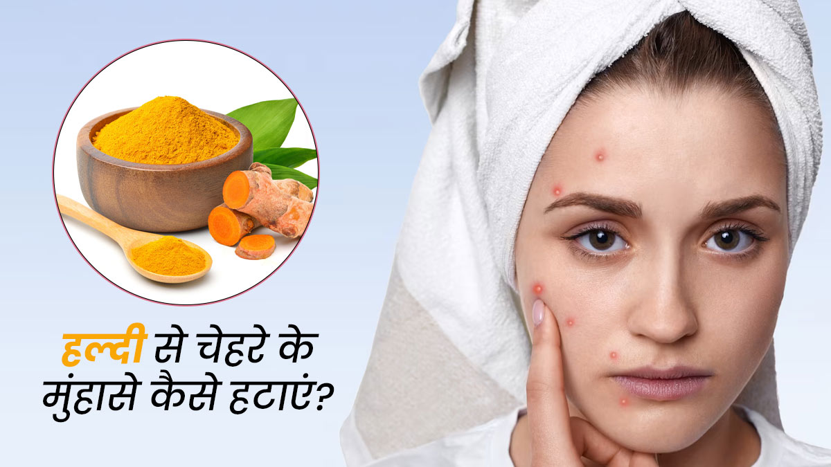 हल्दी से चेहरे के मुंहासे कैसे हटाएं? जानें 3 तरीके और पाएं साफ-निखरी त्वचा