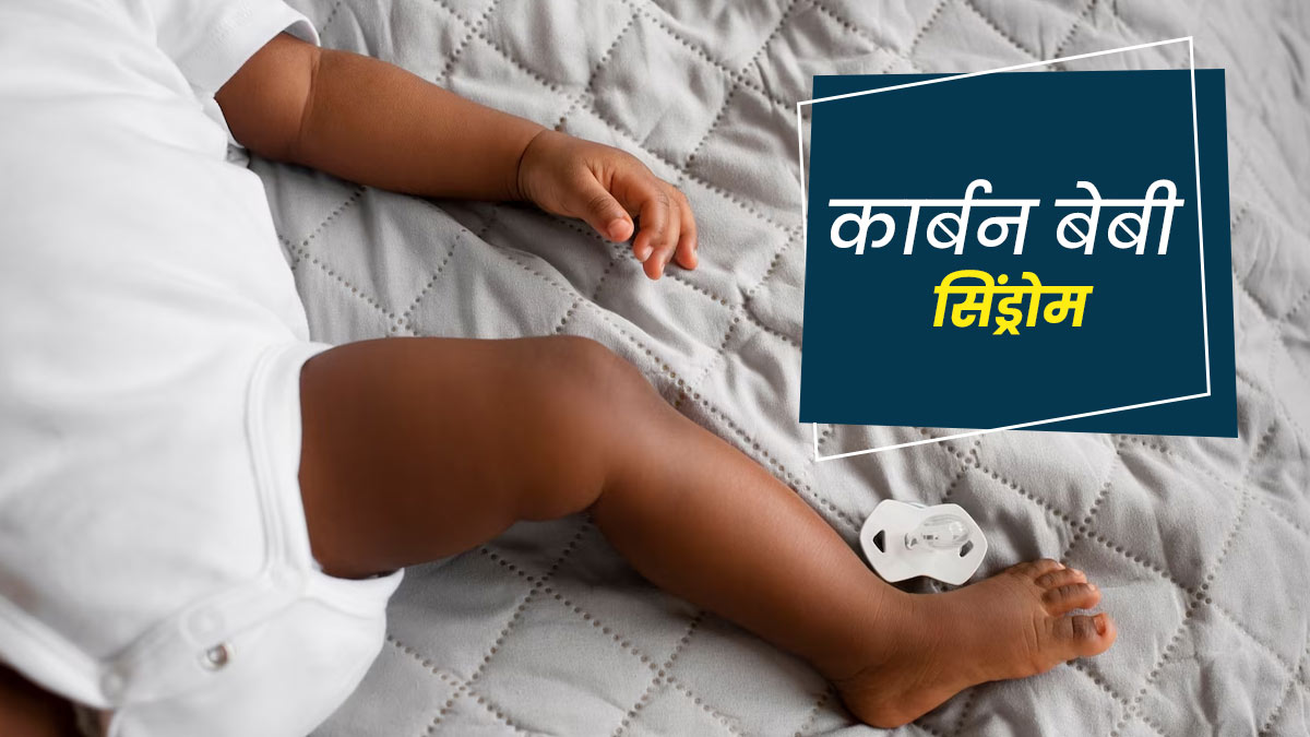 इस बीमारी की वजह से काली पड़ जाती है बच्चों की त्वचा, जानें इसके लक्षण, कारण और इलाज