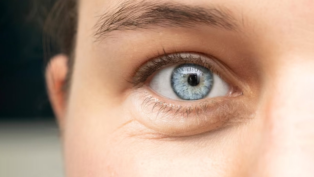 Ways To Get Rid Of Face Puffiness