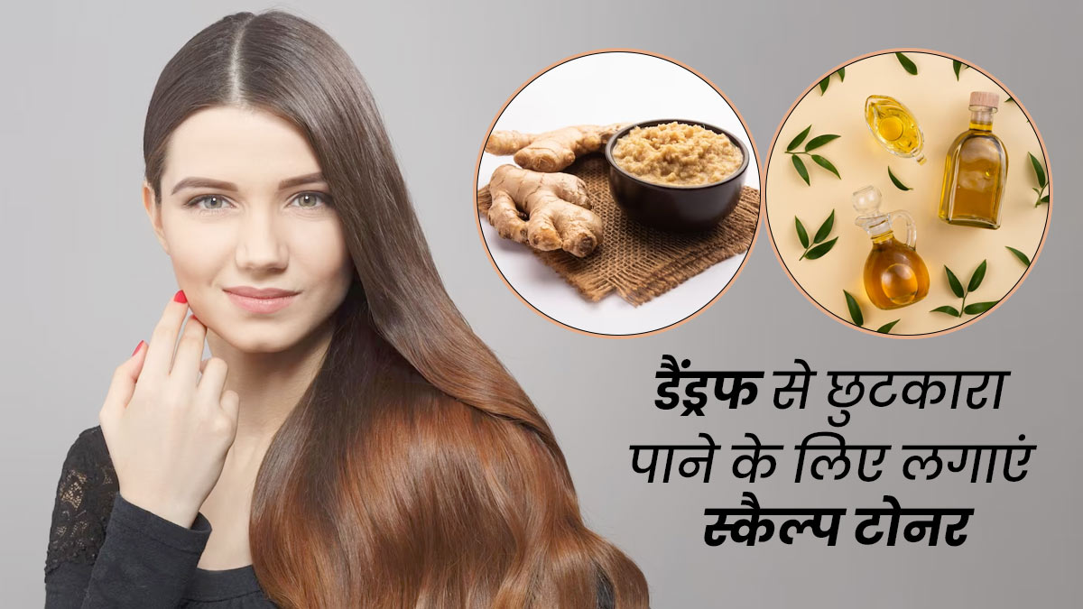 सर्दियों में डैंड्रफ से छुटकारा पाने के लिए इस्तेमाल करें स्कैल्प टोनर, जानें इसे बनाने का तरीका