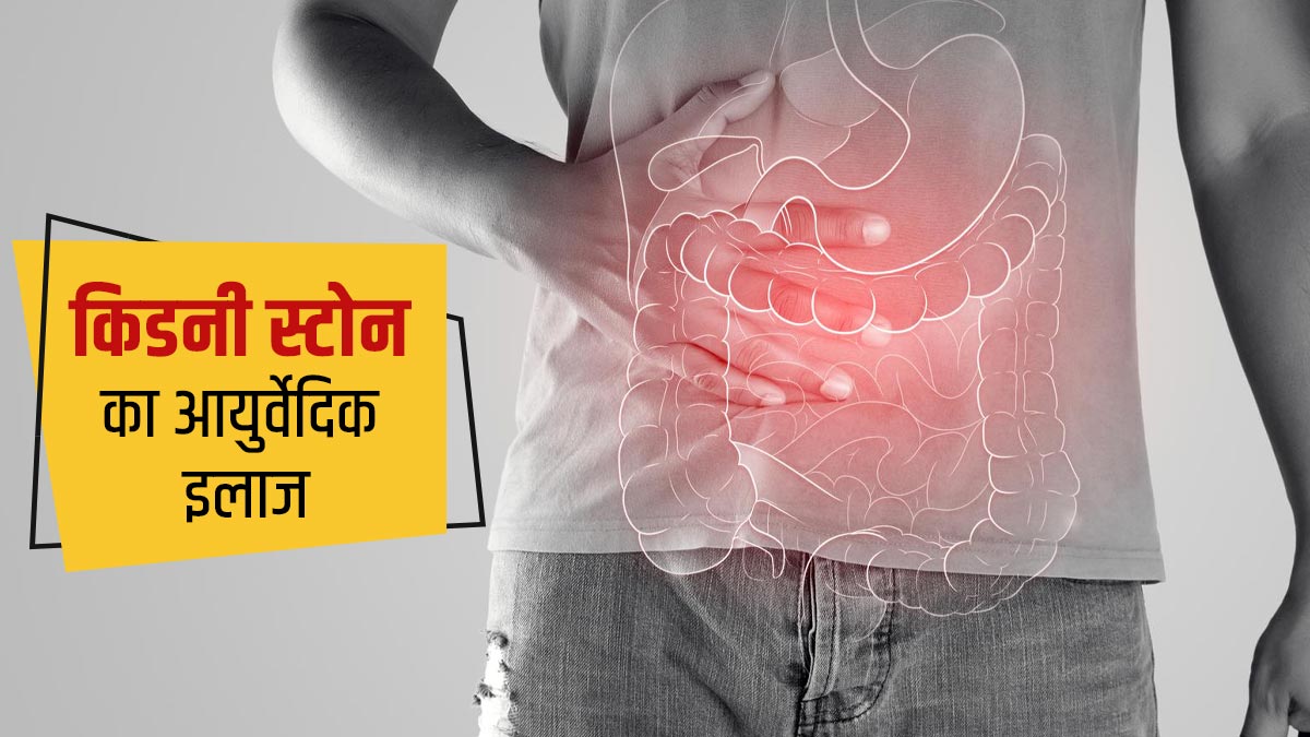 पथरी को गलाकर निकाल देता है ये फल, आयुर्वेदिक डॉक्टर से जानें कैसे करें इस्तेमाल
