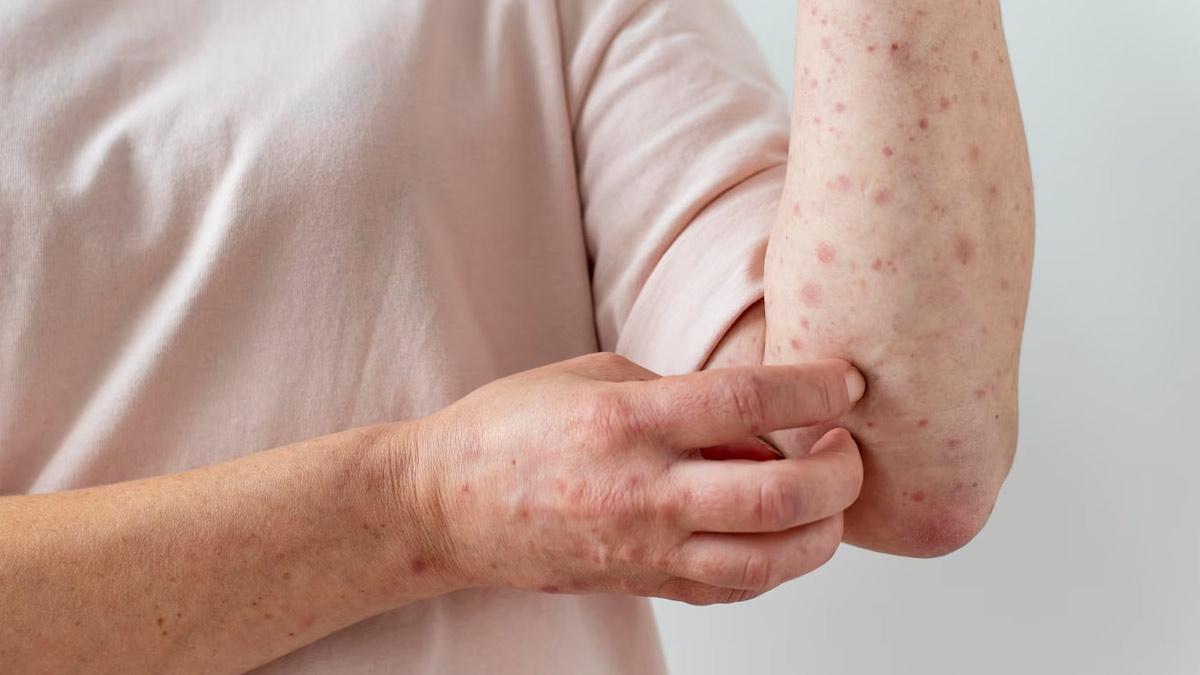 different types of skin allergies