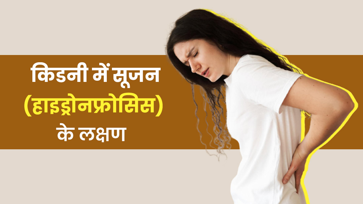 Hydronephrosis Symptoms: किडनी में सूजन (हाइड्रोनफ्रोसिस) होने पर नजर आते हैं ये 5 लक्षण