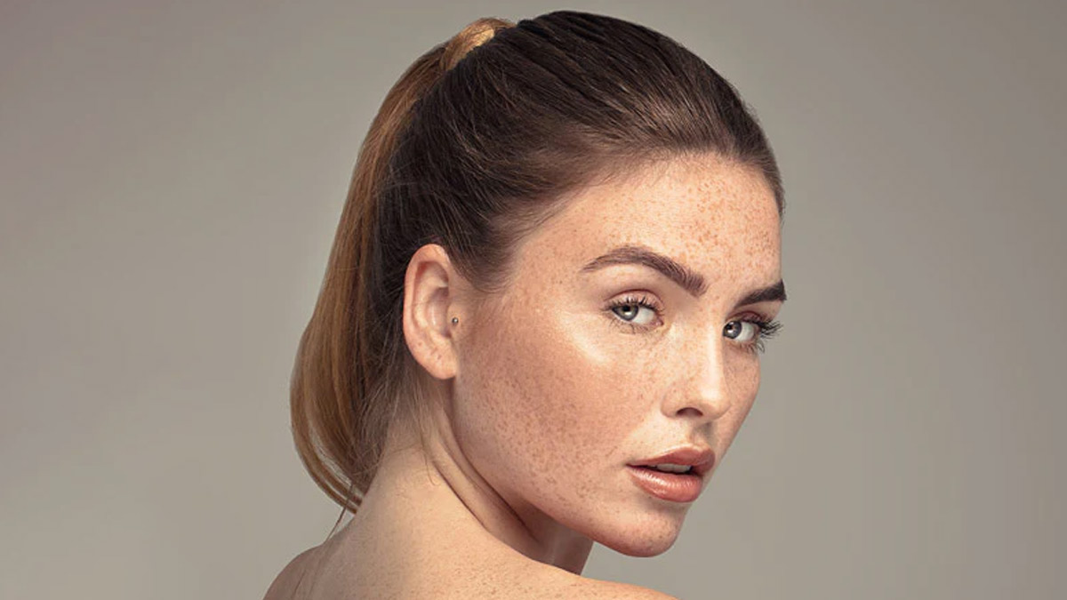 face freckles causes