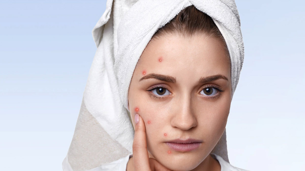 Alum For Dark Spots In Hindi