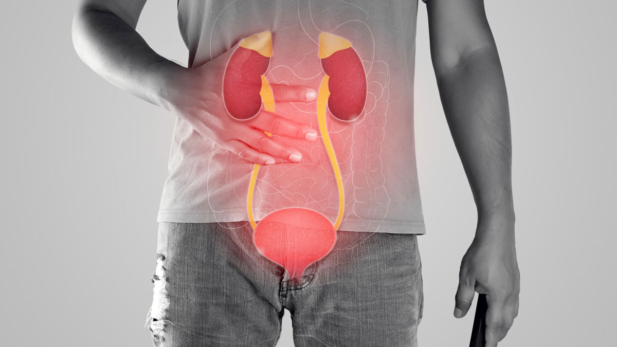 When Is Kidney Replacement Therapy Required