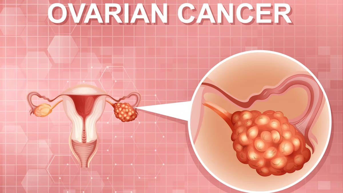 early signs of ovarian cancer in hindi