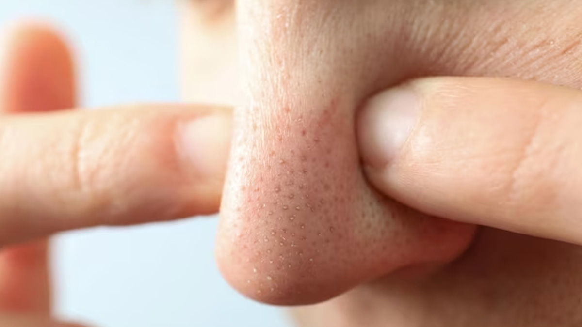 egg whitening in face in hindi