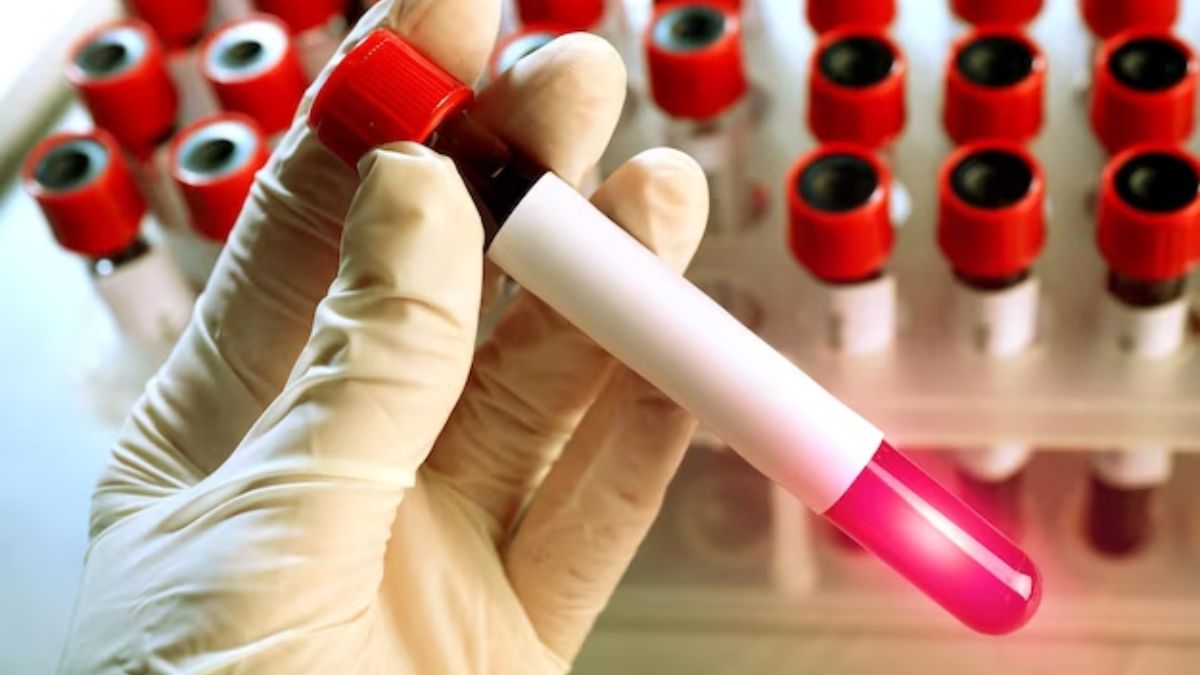 Risk Of Diseases in Humans Due to Pigs And Monkeys