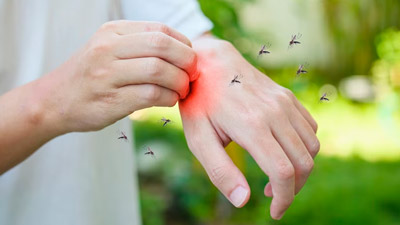 Dengue Danger: 15 Key Questions Answered By Doctor