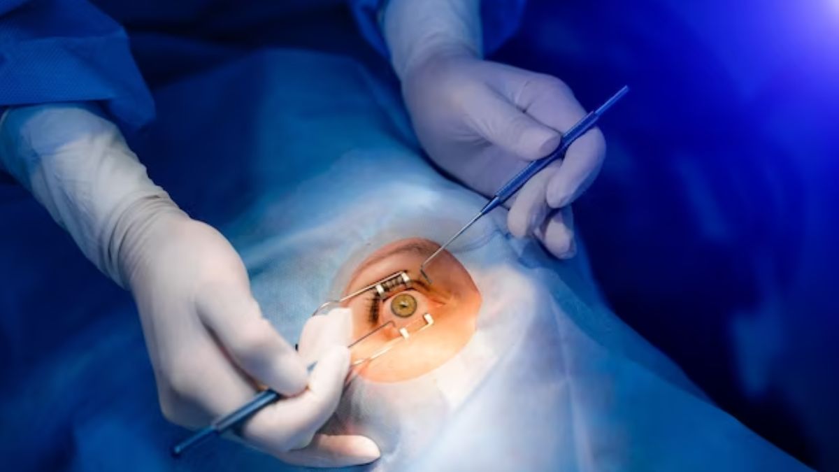 What is ICL Surgery