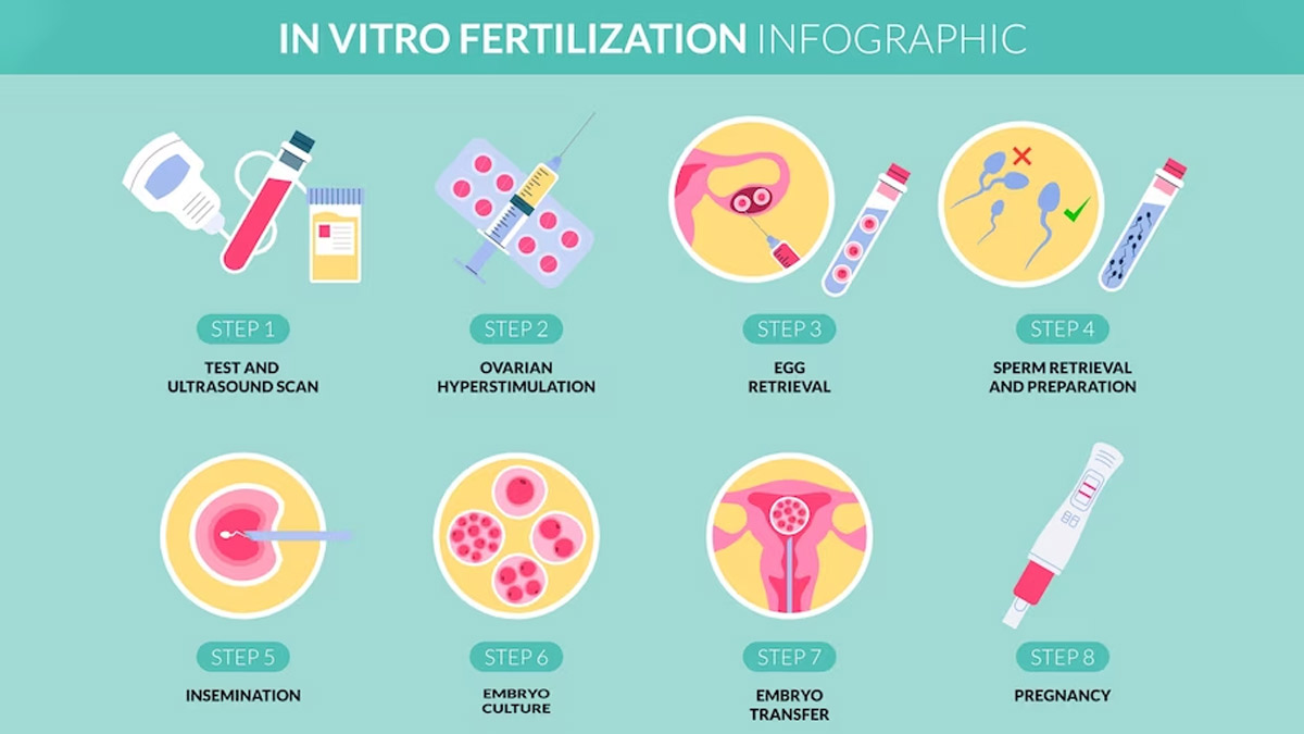 Most Asked Questions On Infertility and IVF answered by doctor