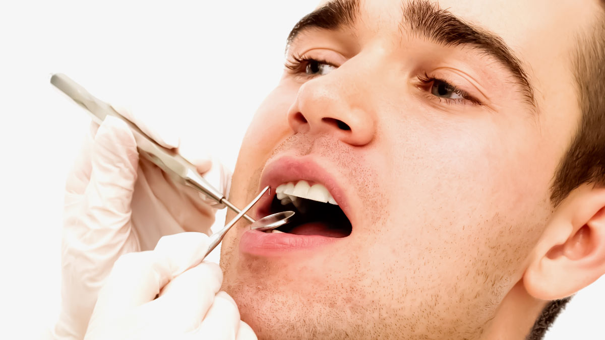 What-is-Tartar-Scraper