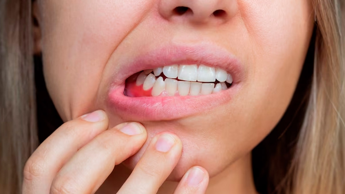 gum discolouration in hindi