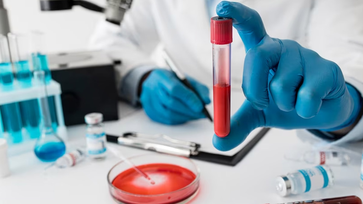 Blood Test To Detect Hepatitis in hindi