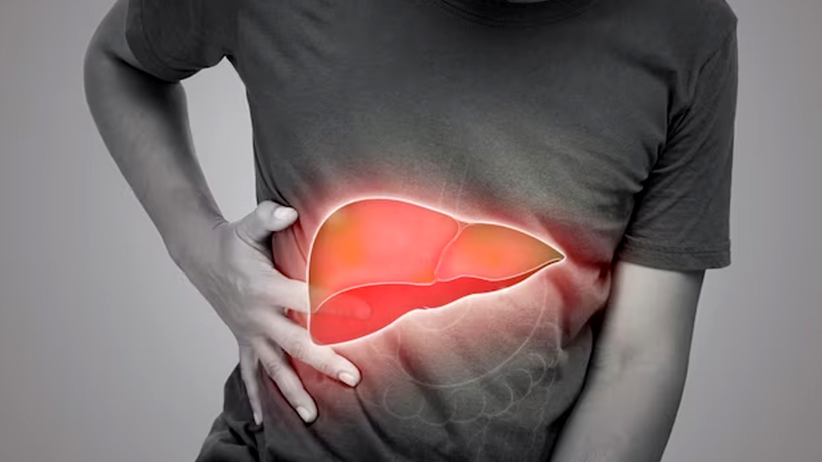Hepatitis May Take A Toll On Your Gastrointestinal Health: Dietary Changes To Minimise 