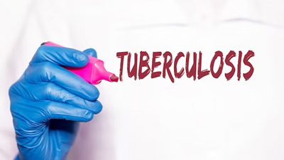 Not Just Your Lungs, Tuberculosis Can Also Affect Other Organs In Your Body: Explained