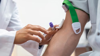 How To Diagnose Tuberculosis: Important Tests You Can Take