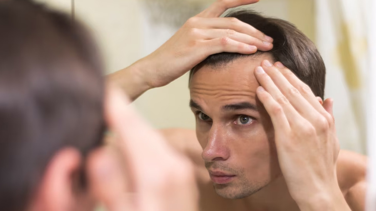 Are You Losing Hair From Temples Know Its Causes And How To Deal With
