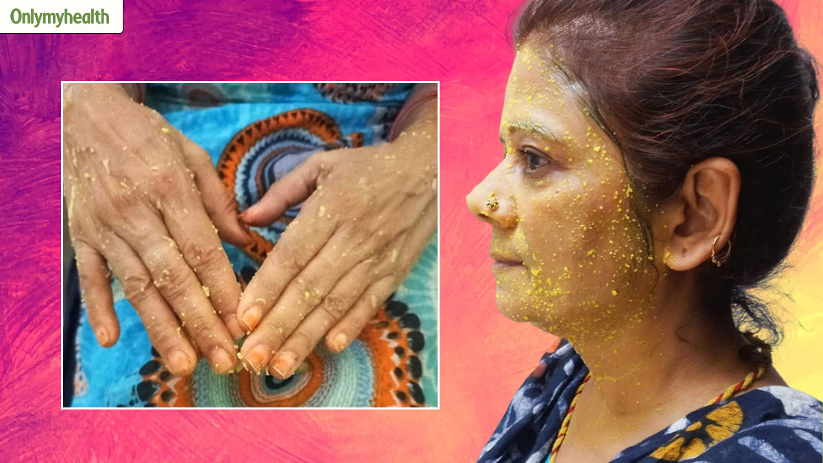 tan removal face pack