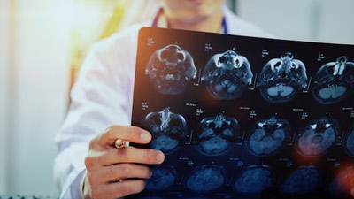 Persistent Headaches To Blurry Vision: Warning Signs Of Brain Tumour To Watch Out For