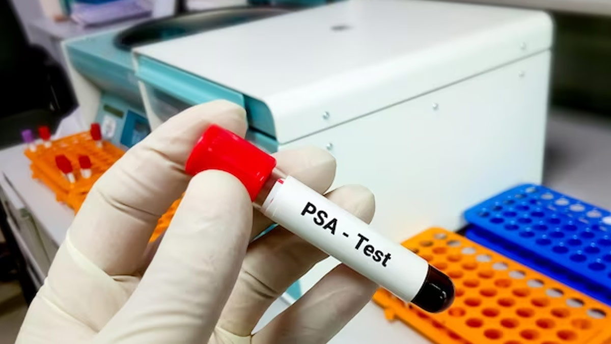 PSA Test For Prostate Cancer Diagnosis: Things Men Need To Know About It