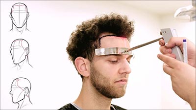 Top 10 Best Hair Transplant Clinics in Turkey